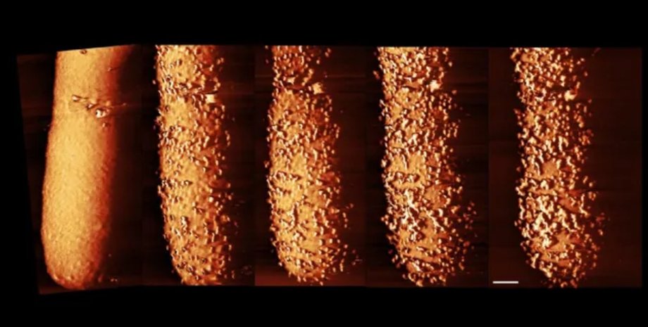 бактерия, антибиотик