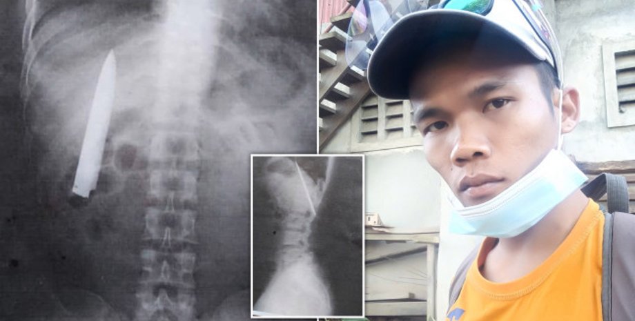 Кент Райан Томао, нож в груди