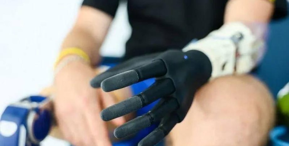 Протез, втрата кінцівки, Україна, українські військові