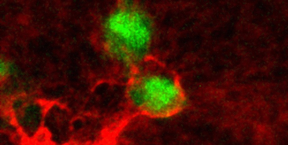 Колаген, білок, молекула, рак