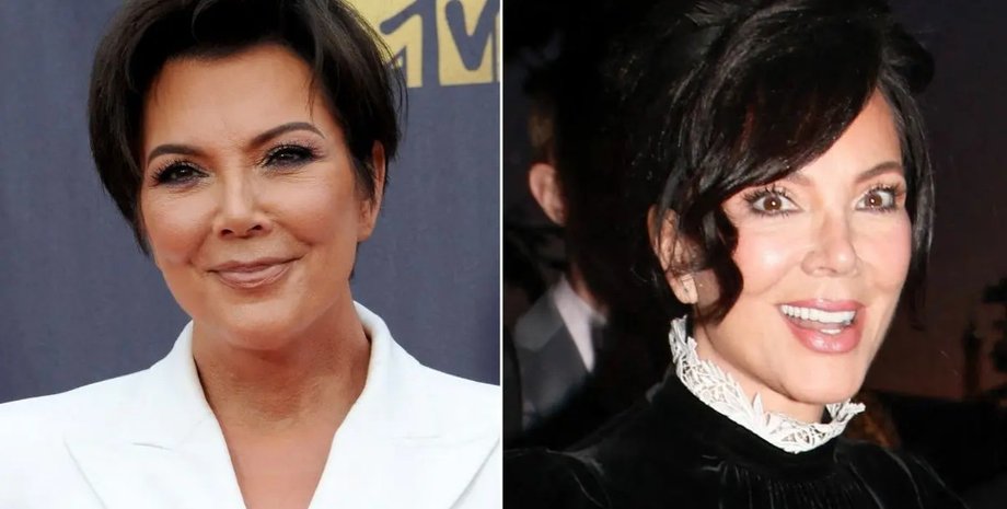 Звезды получают более молодой вид без драматической пластической хирургии