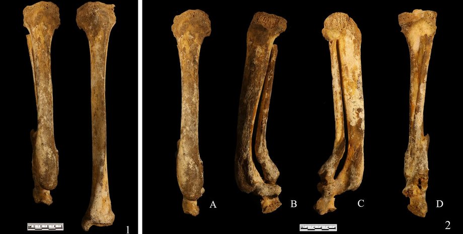 кости, черный фон, фото