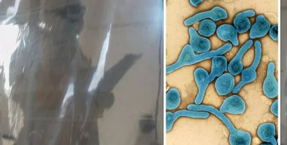 хвороба, Танзанія, кровотеча з носа