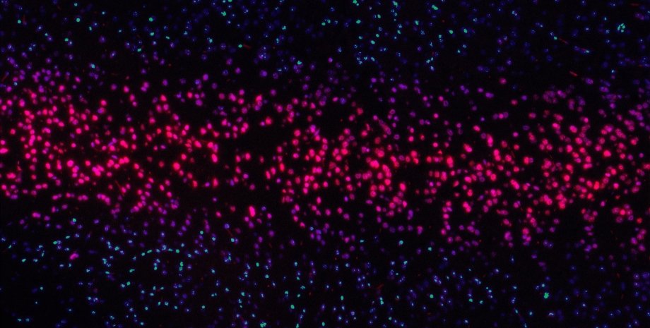 рак радиация, рентген