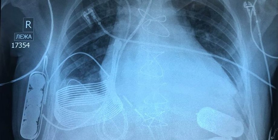 Фото: naked-science.ru