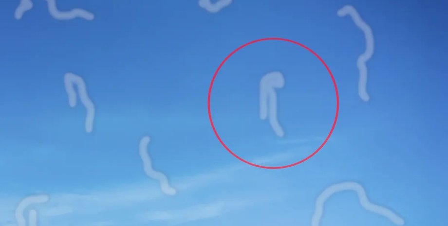 мушки в глазах