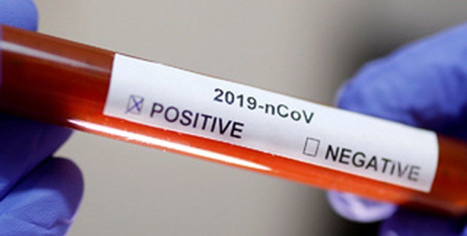 Фото: Украинская правда