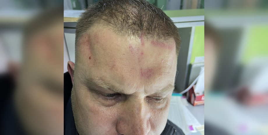 Мэр Белгород-Днестровского Виталий Граждан