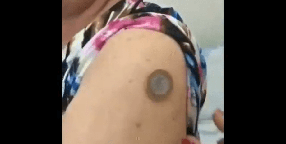 магнетизм, вакцинация от коронавируса, коронавирус, магнит, металл примагничивается, нии гамалеи, вакцина от COVID-19