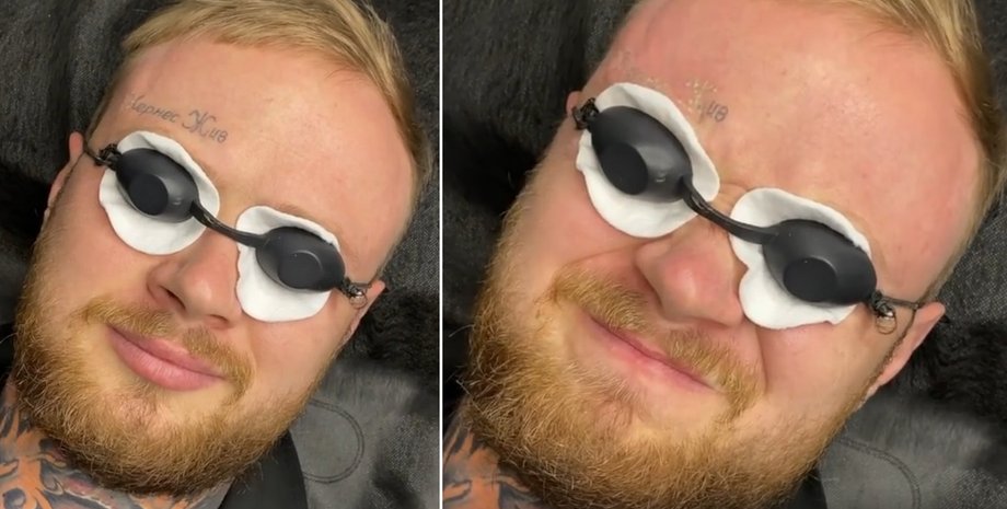 Кернес живий, евгений Івашко, тату на лобі, татуювання