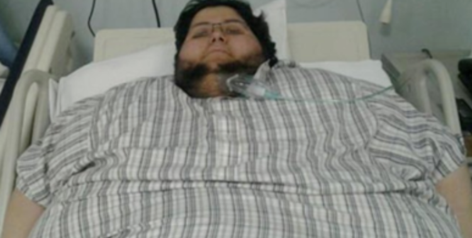 Мужчина похудел до неузнаваемости, внешность, вес, похудение, операция по уменьшению желудка