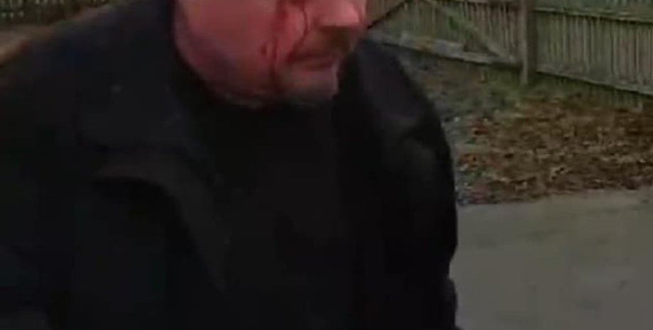 Фото: facebook/Briuhovetskyi