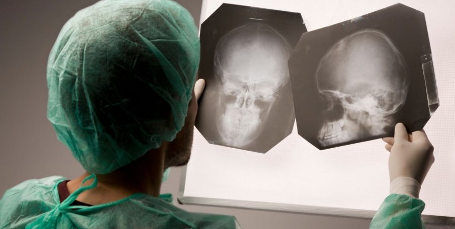 черепно-мозговая травма