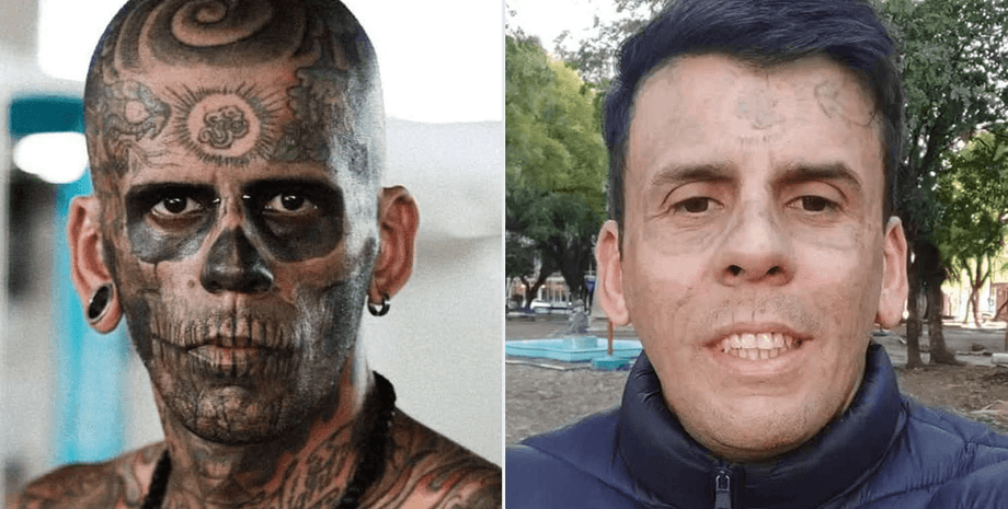 Мужчина с татуировками на лице показал, как выглядит после их удаления с помощью лазера