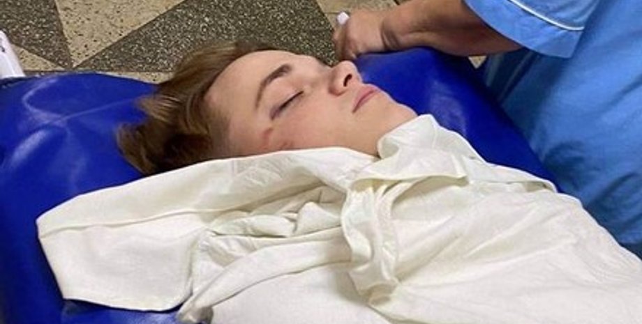 Танцор из коллектива певицы Нади Дорофеевой, которого избили накануне