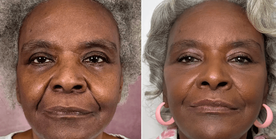 Пластическая операция, хирург, стоимость пластической операции, пластическая операция матери, мать заплатила сыну