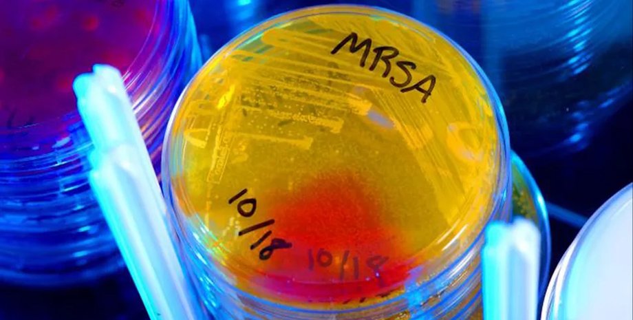 Знайдено новий антибіотик, здатний лікувати небезпечні інфекції: увесь час ховався на виду