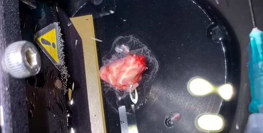 людський мозок