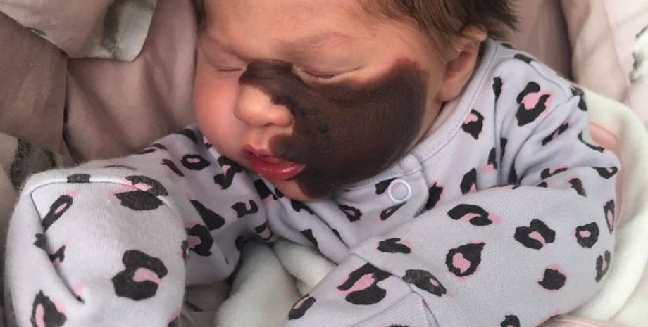 Харпер Кинг, родимка, фото