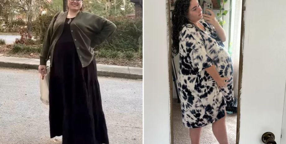 Женщина узнала, что у нее в животе опухоль, хотя до этого думала, что страдает из-за лишнего веса, фото, США