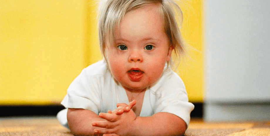 синдром дауна, ученые, 21 хромосома, трисомия, исследование, Япония