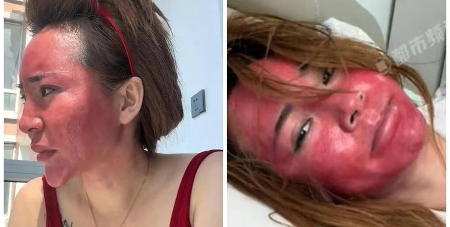 Гао, красное лицо, проблемы с кожей