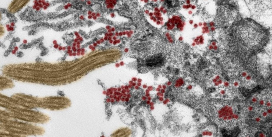 Частицы SARS-CoV-2, отмеченные красным, в клетке обонятельной слизистой оболочки.