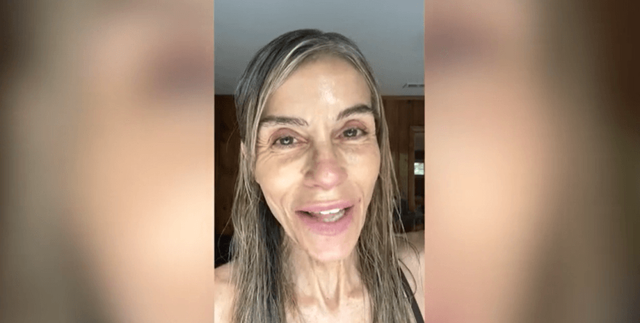 Элоиза Андерсон отказалась от ботокса