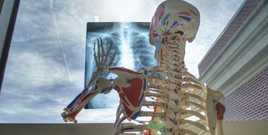 Скелет, рентген, рентгенівське випромінювання