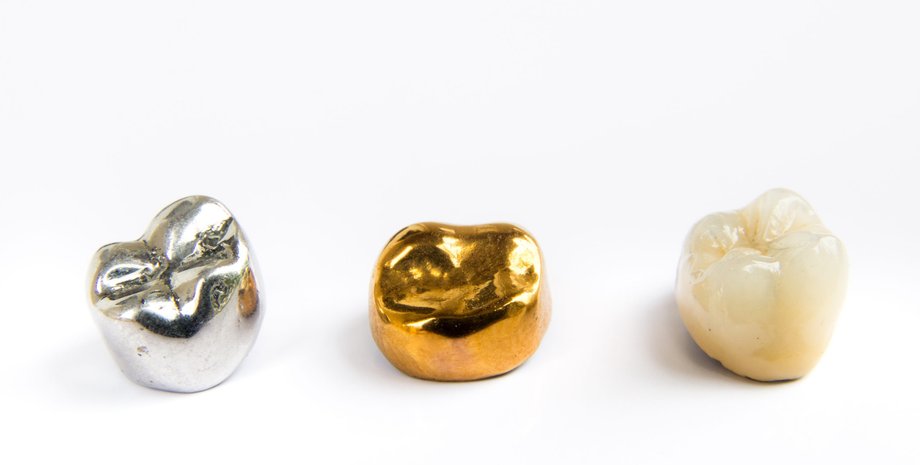 коронки, золото, серебро, фото