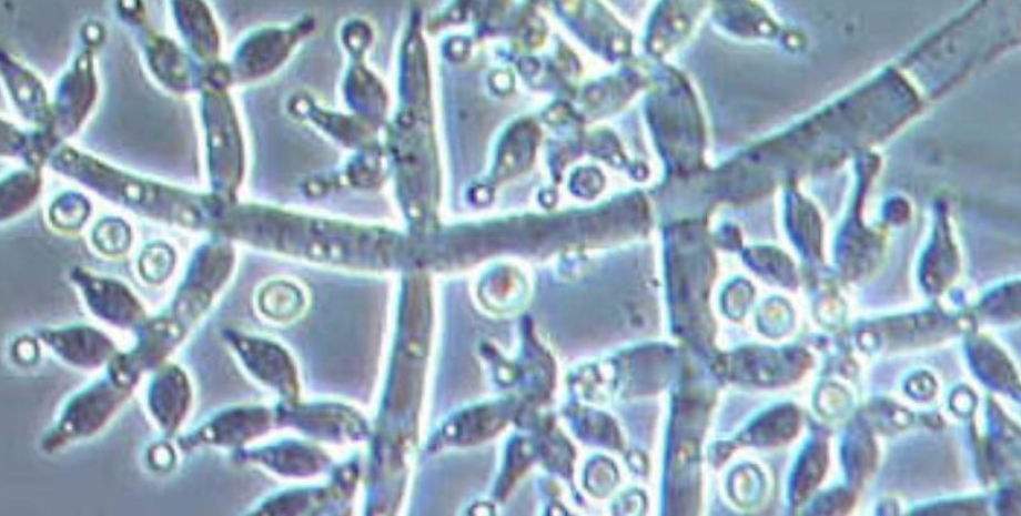 Безстатеві спори грибів Trichoderma harzianum грибок, ріст грибка, грибок ріст, грибок ріст