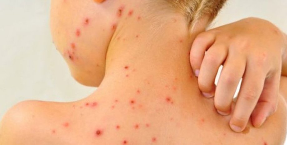 Иллюстративное фото