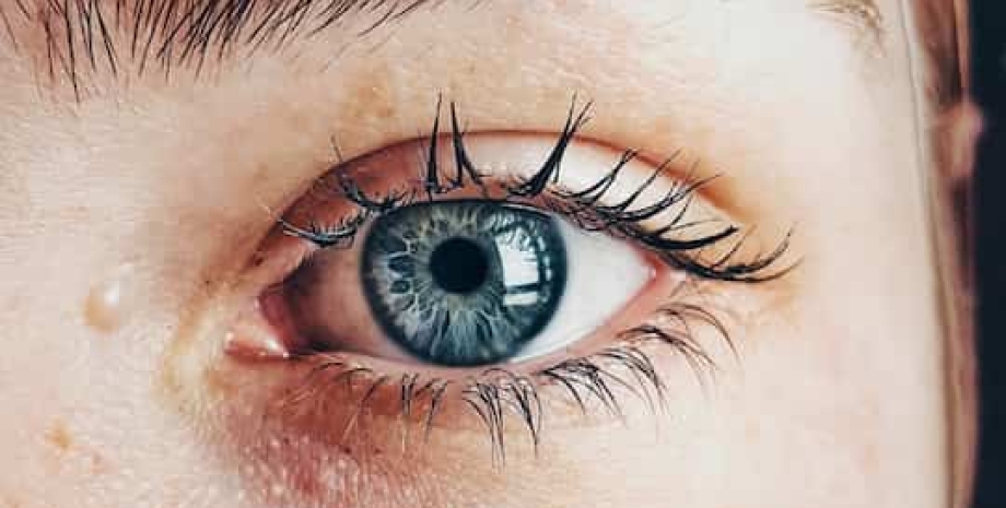 глаза, глаукома, заболевание глаз