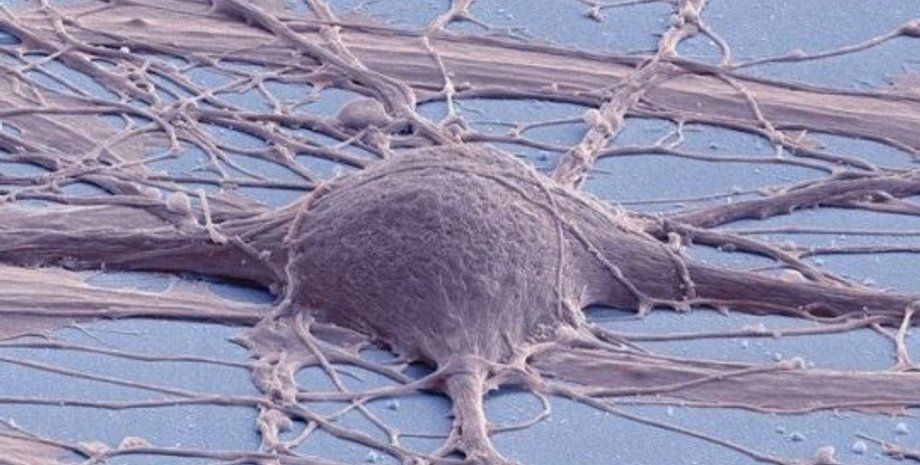 Нейрон, выращенный из стволовой клетки. Фото: Mark Ellisman and Thomas Deerinck, National Center for Microscopy and Imaging Research, UC San Diego