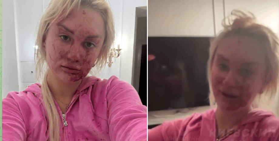 Женщина пожаловалась на абьюз мужа