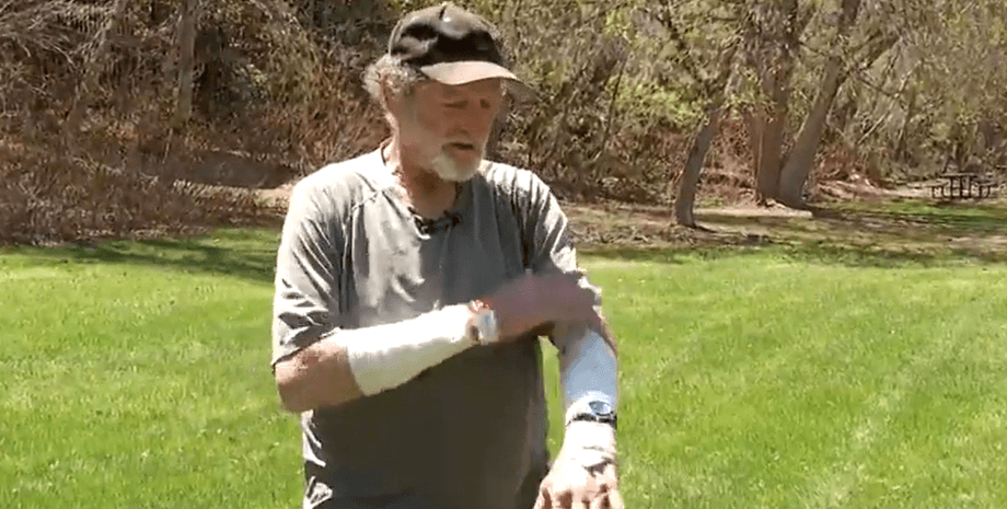 Пенсіонер, чоловік, турист, пережив напад пуми,