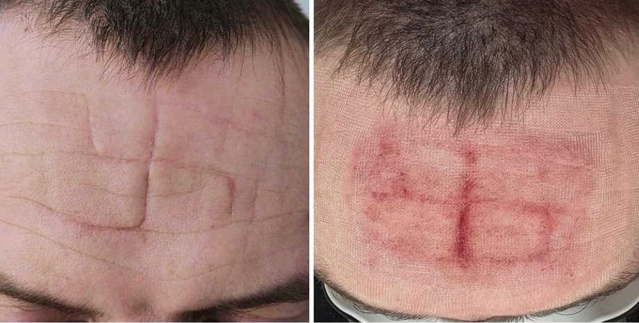 свастика це, нацистська свастика, що таке свастика, свастика це, катування, тортури, російський полон