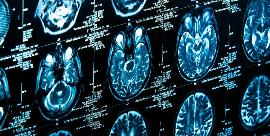 Фото: svedoliver/Depositphotos