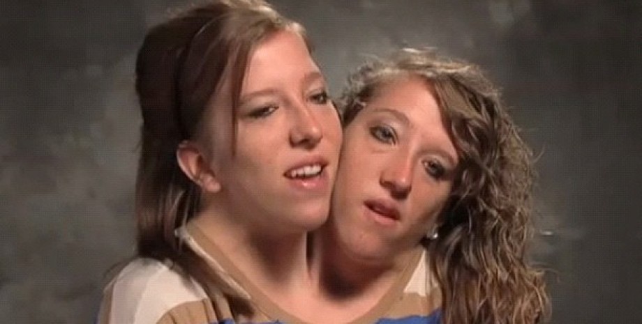 Эбби и Бриттани Хенсел Эбби и Бриттани Хенсел