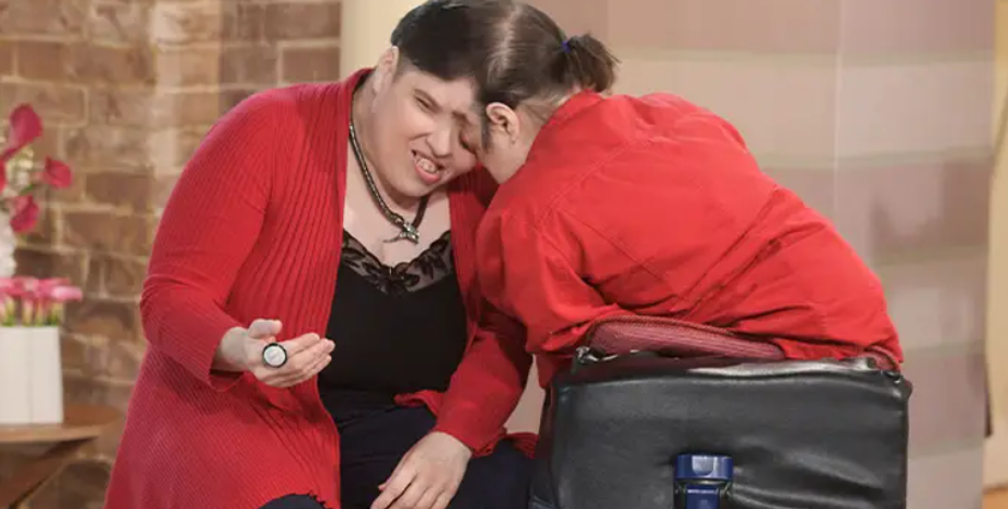 Сиамские близнецы, Книга рекордов Гиннесса, аномалии, курьезы, странные диагнозы, США, фото