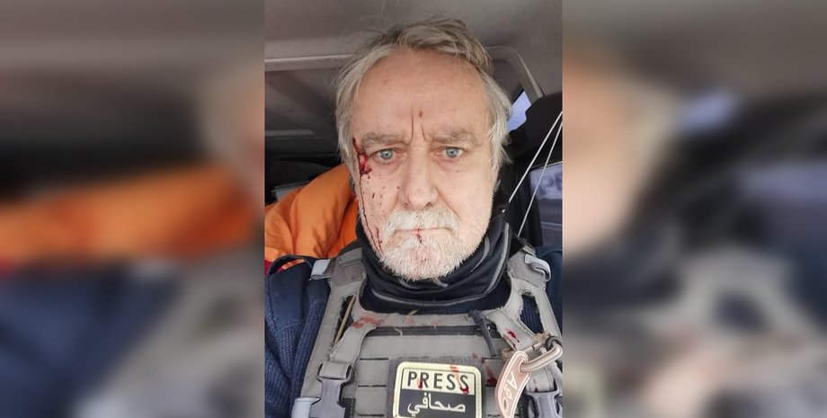 Обстрелянный транспорт, французский журналист, обстрелы