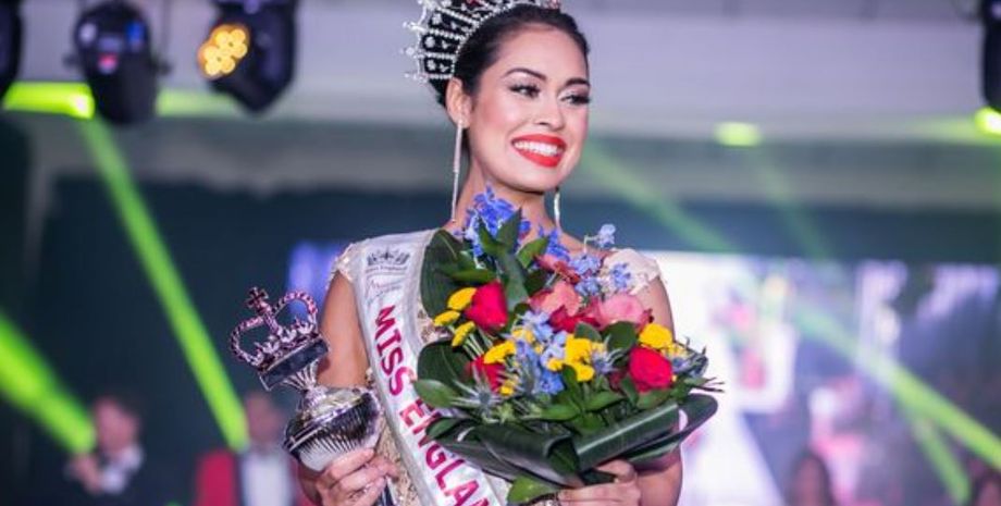 Облысение у женщин, потеря волос, конкурс красоты, внешность, идеал красоты, идеал красоты, трансформация внешности