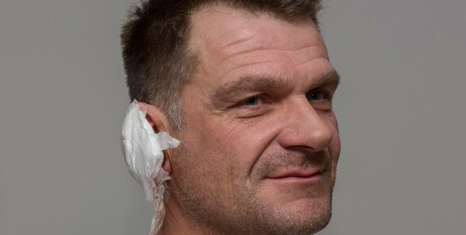 Пострадавший от егеря Патрик Панкс Фото: The Sun