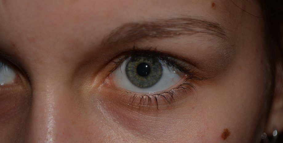 значение родинок, что значат родинки, о чем говорят родинки