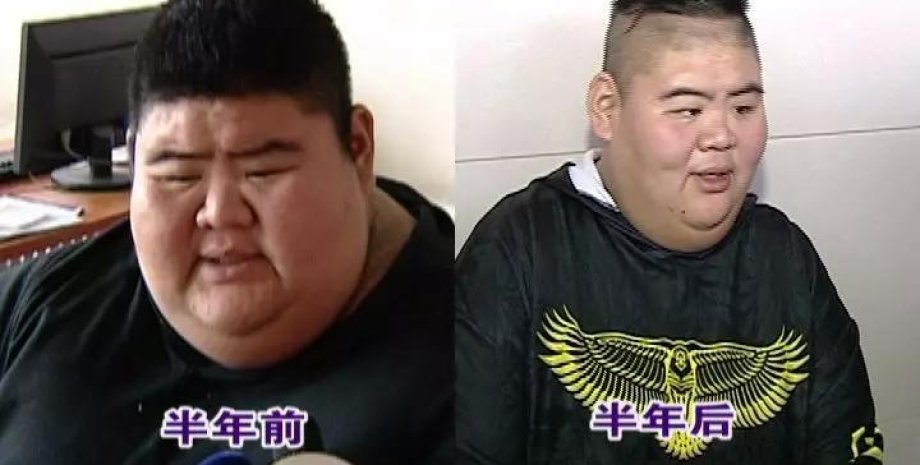 Ван Хаонань до и после похудения. Фото: qiluhospital.com