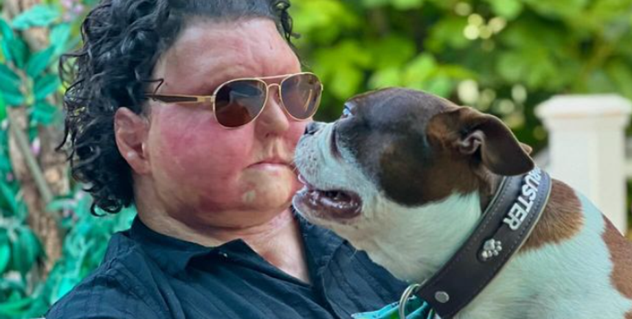 Пересадка лица, Джо ДиМео из США, реакция собак, курьезы, хирургическое вмешательство, аномалии, интересные истории, видео