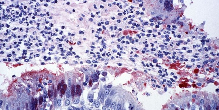 Фото: pixnio.com