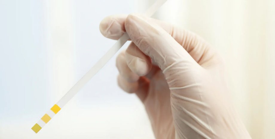 тест, перчатка