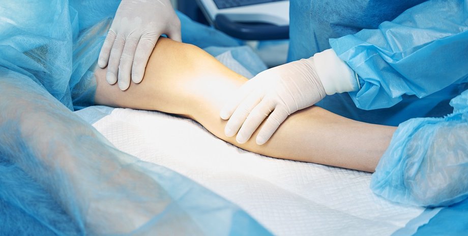 удлинение ног, плстическая хирургия