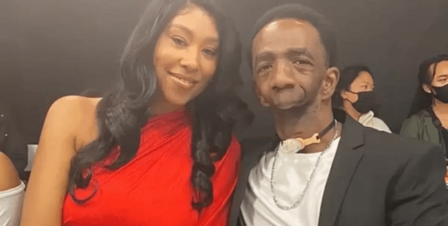 Чоловік без щелепи, народився без щелепи, чоловік без нижньої половини обличчя, знайшов своє кохання, одружився з колегою, рідкісне захворювання, не може говорити,